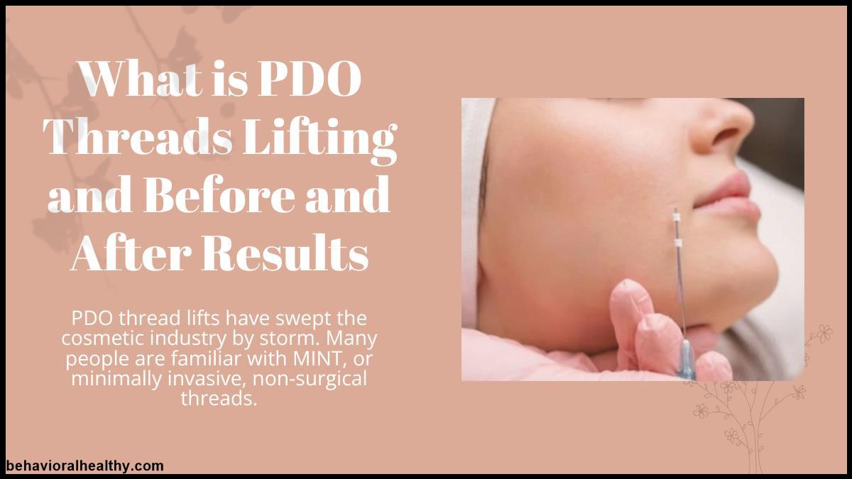 What is PDO Threads Lifting and Before and After Results.jpg